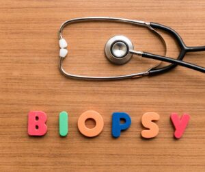 Read more about the article Biopsia percutanată a ganglionilor