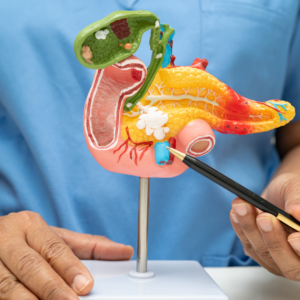 Read more about the article Rolul radiologiei intervenționale în cancerul pancreatic