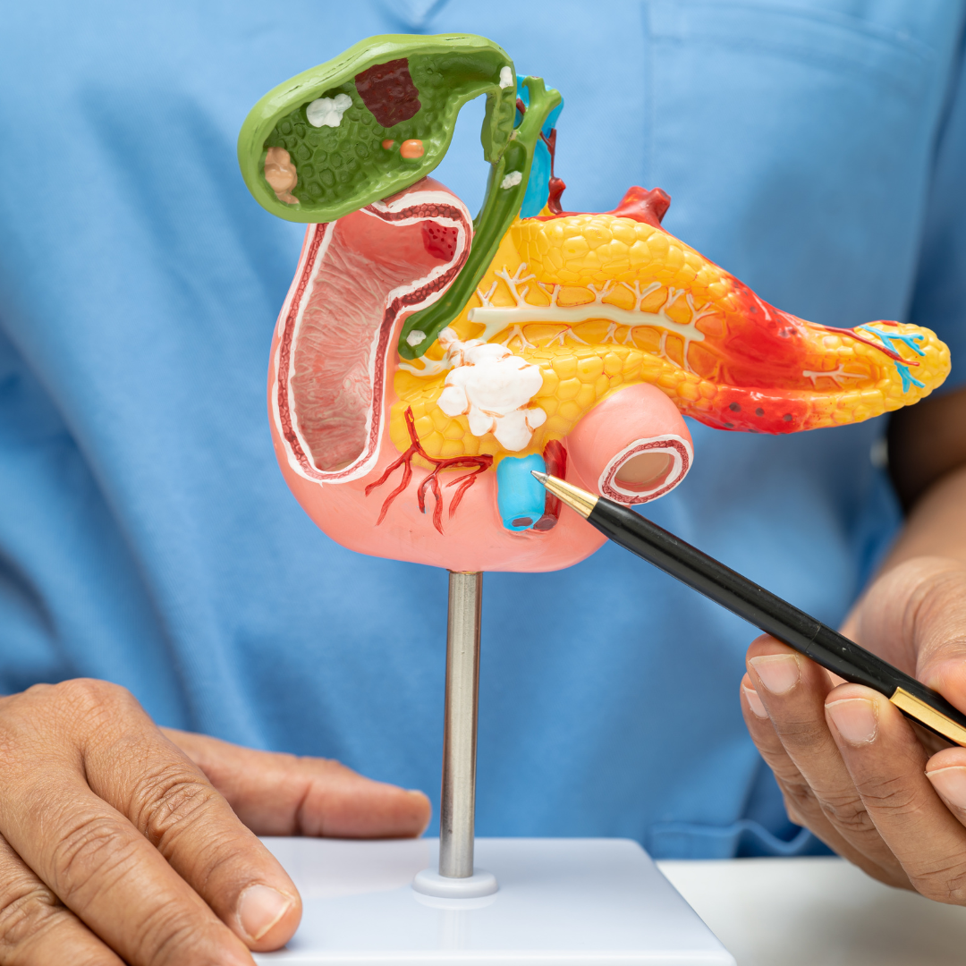 You are currently viewing Rolul radiologiei intervenționale în cancerul pancreatic