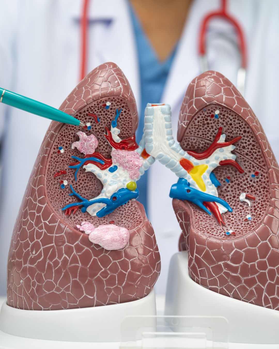 You are currently viewing Biopsia pulmonară cu ac: indicații, procedură, riscuri și beneficii