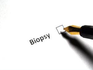Read more about the article Biopsia cu ac în cancerul mamar: ce este și cum se realizează